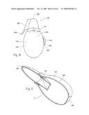 Irrigation and aspiration devices and methods diagram and image