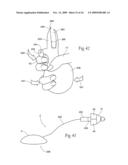 Irrigation and aspiration devices and methods diagram and image