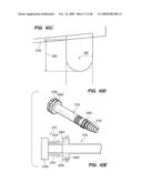 DEVICES, SYSTEM AND METHODS FOR MINIMALLY INVASIVE ABDOMINAL SURGICAL PROCEDURES diagram and image