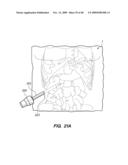 DEVICES, SYSTEM AND METHODS FOR MINIMALLY INVASIVE ABDOMINAL SURGICAL PROCEDURES diagram and image