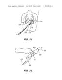 DEVICES, SYSTEM AND METHODS FOR MINIMALLY INVASIVE ABDOMINAL SURGICAL PROCEDURES diagram and image