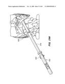 DEVICES, SYSTEM AND METHODS FOR MINIMALLY INVASIVE ABDOMINAL SURGICAL PROCEDURES diagram and image