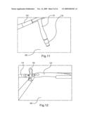 Laparoscopic Gastric and Intestinal Trocar diagram and image