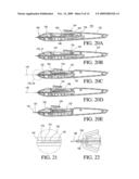 Ocular Implantation Device diagram and image