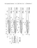 Ocular Implantation Device diagram and image