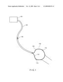 ARRANGEMENT FOR USE WITH A BALLOON ABLATION CATHETER diagram and image