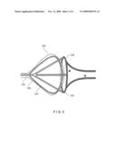 ARRANGEMENT FOR USE WITH A BALLOON ABLATION CATHETER diagram and image