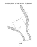 ANASTOMOSIS PATCH diagram and image