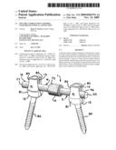 Dynamic stabilization assembly with frusto-conical connection diagram and image