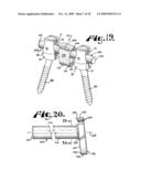 Dynamic stabilization assembly with frusto-conical connection diagram and image