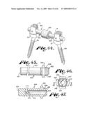 Dynamic stabilization assembly with frusto-conical connection diagram and image