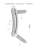 MINIMALLY INVASIVE SPINAL STABILIZATION SYSTEM diagram and image