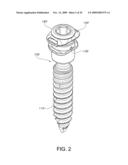 MINIMALLY INVASIVE SPINAL STABILIZATION SYSTEM diagram and image