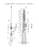 MINIMALLY INVASIVE SPINAL STABILIZATION SYSTEM diagram and image