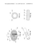 MINIMALLY INVASIVE SPINAL STABILIZATION SYSTEM diagram and image