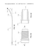 MINIMALLY INVASIVE SPINAL STABILIZATION SYSTEM diagram and image