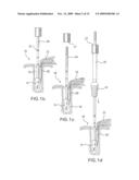 Method and device for securing sutures to bones diagram and image