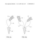 Method and device for securing sutures to bones diagram and image