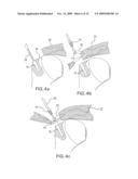 Method and device for securing sutures to bones diagram and image