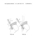 Method and device for securing sutures to bones diagram and image