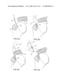 Method and device for securing sutures to bones diagram and image