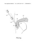 Method and device for securing sutures to bones diagram and image