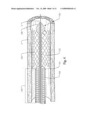 DELIVERY SYSTEM WITH LOW LONGITUDINAL COMPRESSIBILITY diagram and image