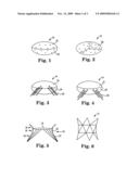 Prosthetic Heart Valve Devices and Methods of Valve Replacement diagram and image