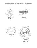 Prosthetic Heart Valve Devices and Methods of Valve Replacement diagram and image