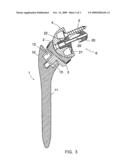 SHOULDER PROSTHESIS AND SET OF INSTRUMENTS FOR THE IMPLANTATION THEREOF diagram and image