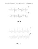 DISPERSION FILTERING FOR SPEECH INTELLIGIBILITY ENHANCEMENT diagram and image