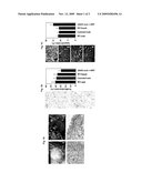 Androgen Receptor Related Methods for Treating Bladder Cancer diagram and image