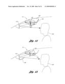 VEHICLE VISION SYSTEM diagram and image