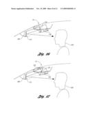 VEHICLE VISION SYSTEM diagram and image