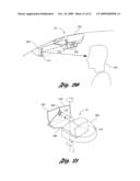 VEHICLE VISION SYSTEM diagram and image