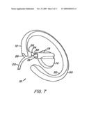 EARHOOK AND EARBUD HEADSET diagram and image