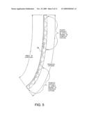 Loudspeaker Having a Continuous Molded Diaphragm diagram and image