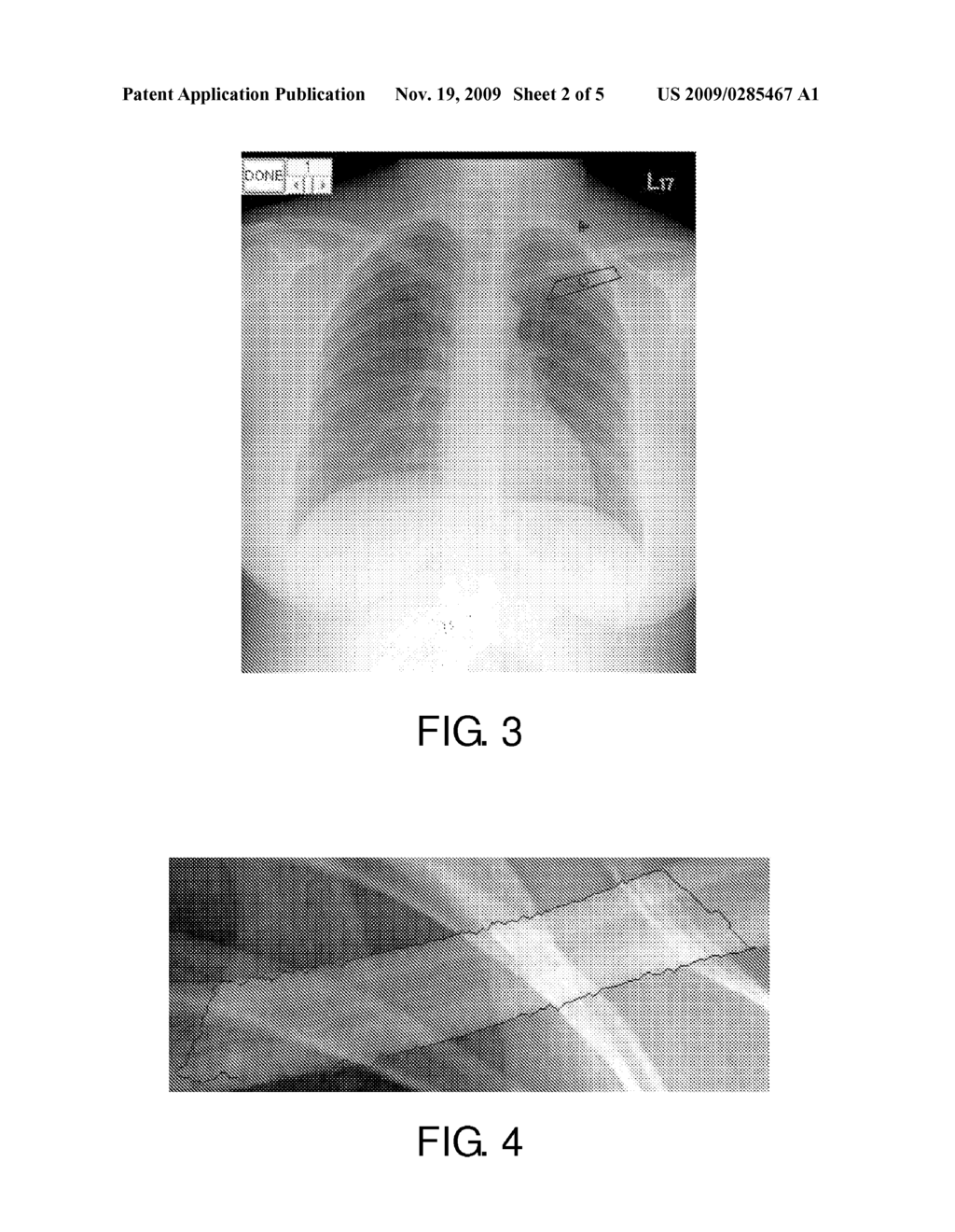 METHOD FOR ASSESSING BONE STATUS - diagram, schematic, and image 03