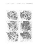 ANTAGONIST ANTIBODIES AGAINST GDF-8 AND USES IN TREATMENT OF ALS AND OTHER GDF-8 ASSOCIATED DISORDERS diagram and image