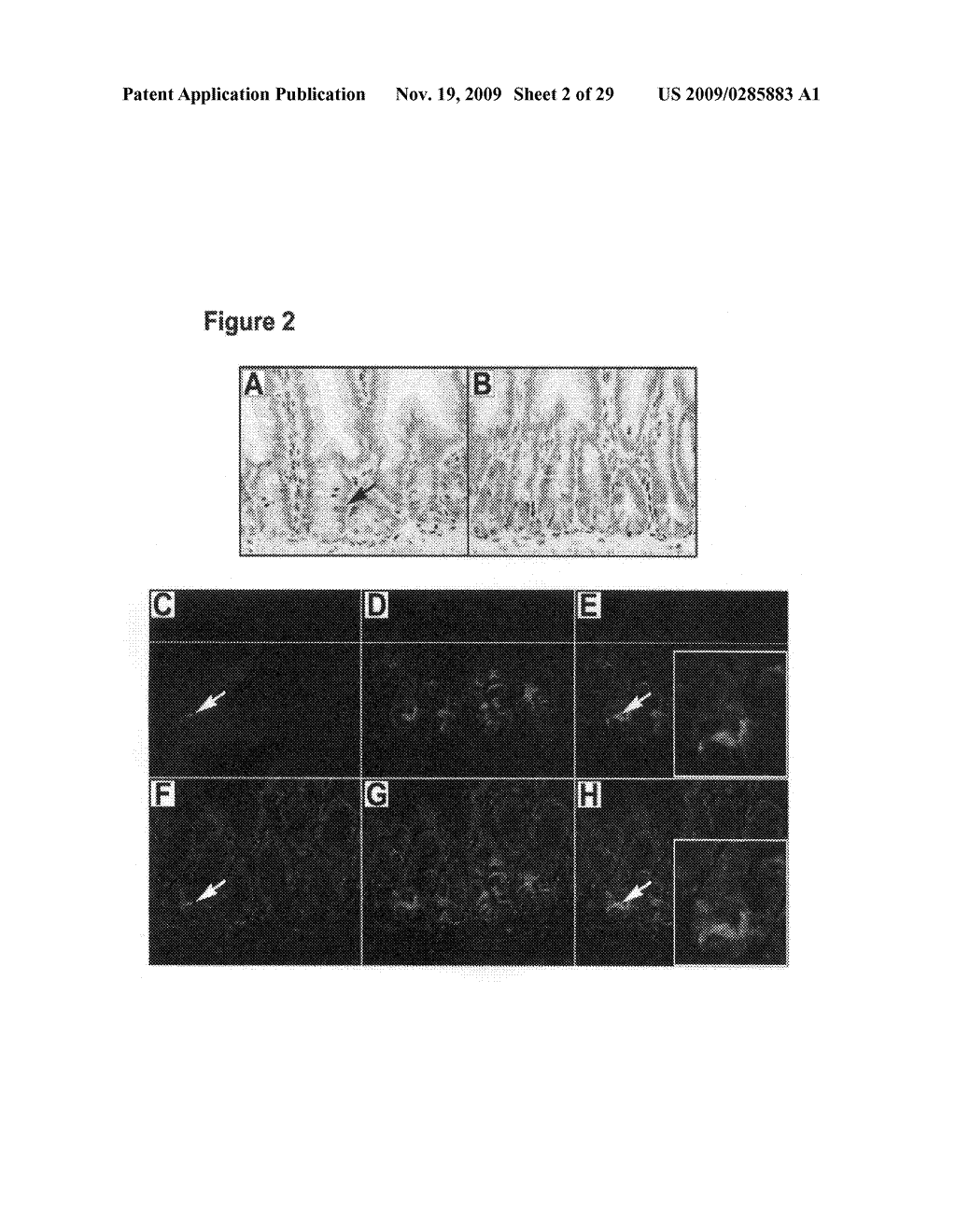 Identification of gastrointestinal, pancreatic and cancer stem cell markers and methods of use thereof - diagram, schematic, and image 03