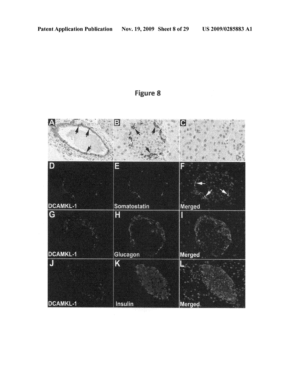 Identification of gastrointestinal, pancreatic and cancer stem cell markers and methods of use thereof - diagram, schematic, and image 09