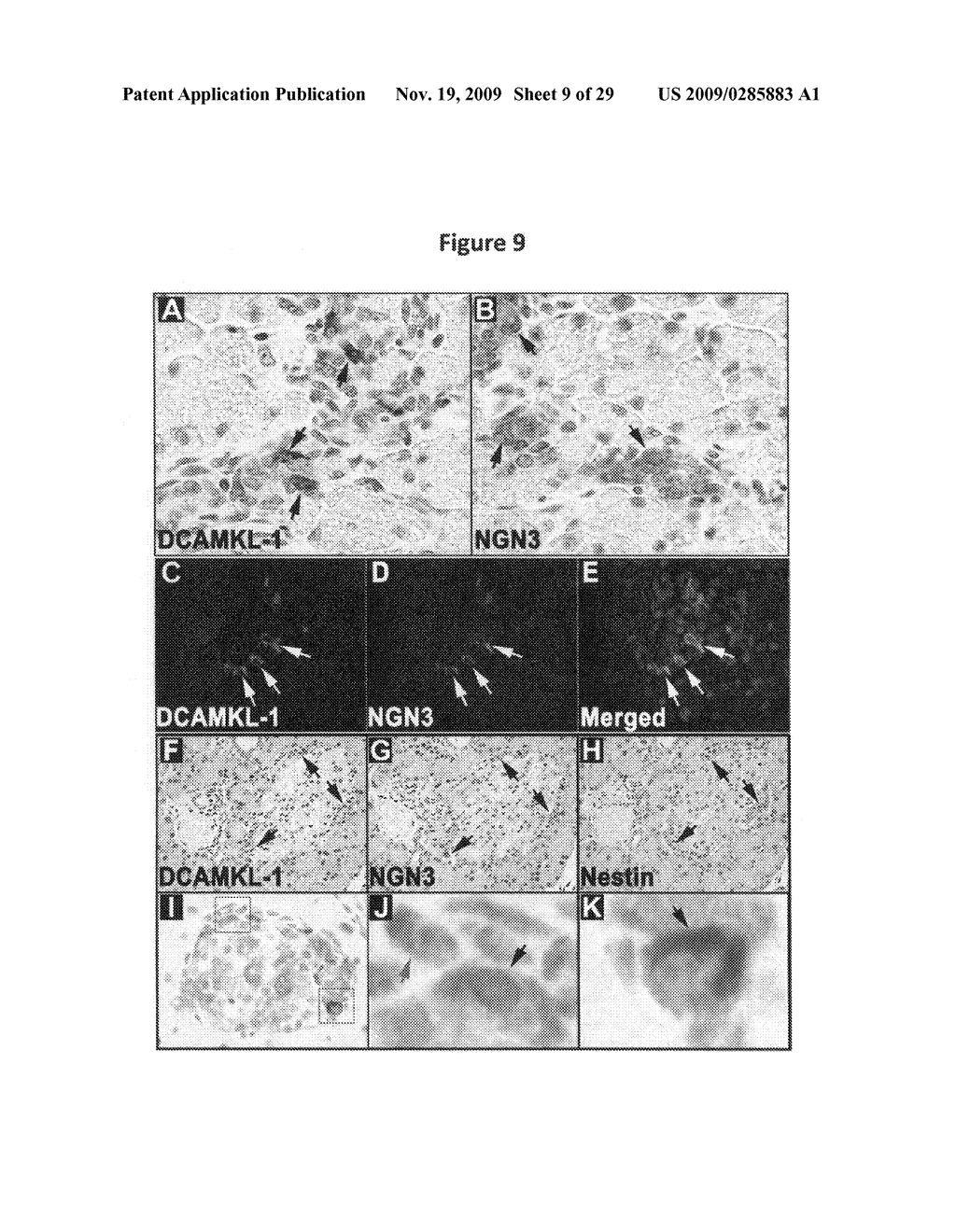 Identification of gastrointestinal, pancreatic and cancer stem cell markers and methods of use thereof - diagram, schematic, and image 10