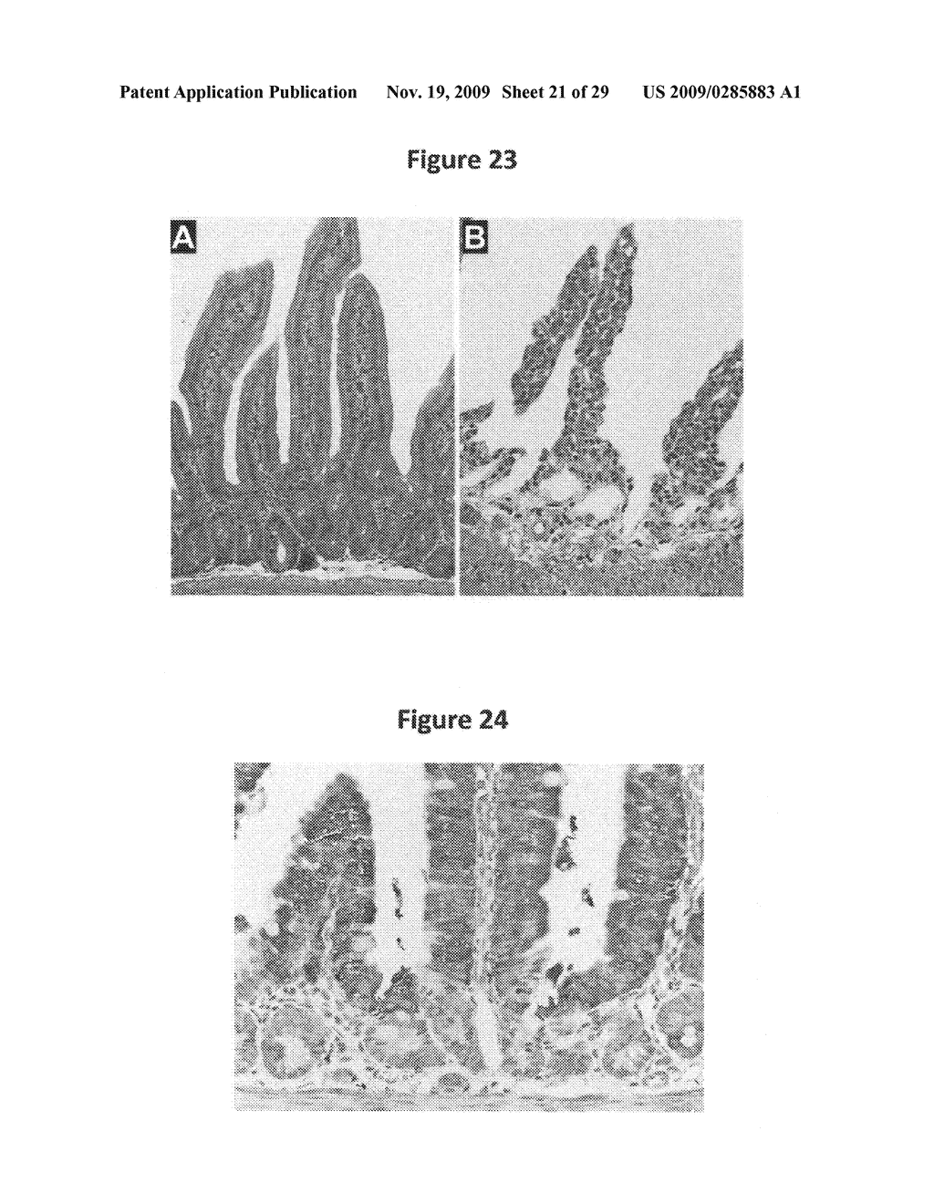 Identification of gastrointestinal, pancreatic and cancer stem cell markers and methods of use thereof - diagram, schematic, and image 22