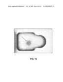 Methods, Devices, Kits and Compositions for Detecting Whipworm diagram and image