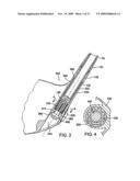 GOLF CLUB diagram and image