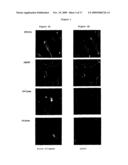 PHARMACEUTICAL COMPOSITION FOR THE DIAGNOSIS, PREVENTION OR TREATMENT OF A TUMORAL PATHOLOGY COMPRISING AN AGENT MODULATING THE POLYMERIZATION STATE OF ACTIN diagram and image