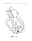 PERIPHERAL SEAL FOR A VENTRICULAR PARTITIONING DEVICE diagram and image