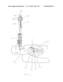 Access Systems Including Collapsible Port Body For Intra-Abdominal Surgery diagram and image