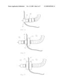 Access Systems Including Collapsible Port Body For Intra-Abdominal Surgery diagram and image