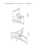 DEVICES FOR CREATING PASSAGES AND SENSING FOR BLOOD VESSELS diagram and image